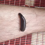 leech attached